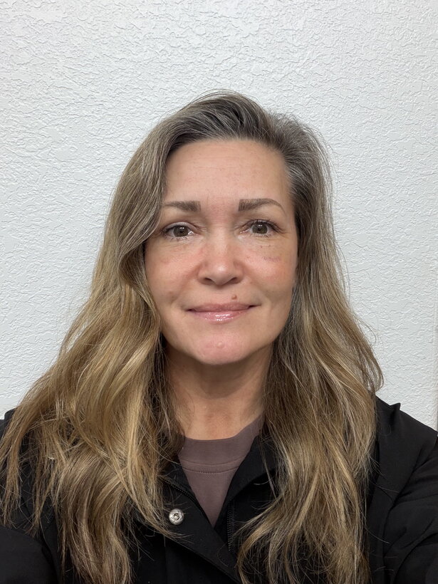 Eye area about three weeks after eyelid surgery, most bruising resolved